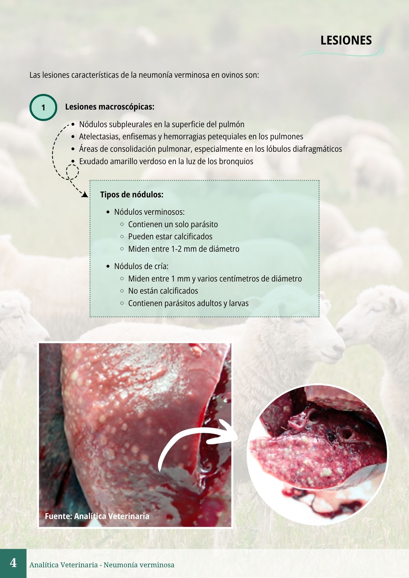 Neumonía verminosa 4